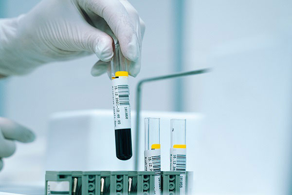 Test Tubes