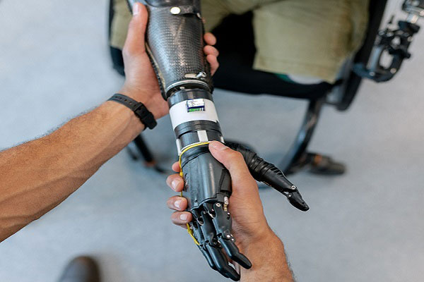 Prosthetic Arm